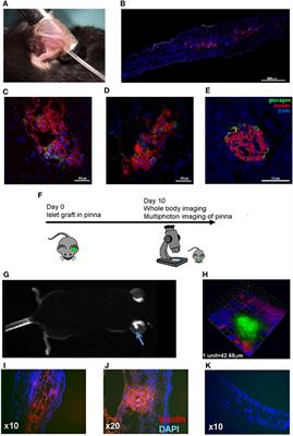 Non-Invasive Multiphoton Imaging of Islets Transplanted Into the Pinna of the NOD Mouse Ear Reveals the Immediate Effect of Anti-CD3 Treatment in Autoimmune Diabetes